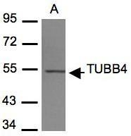 NBP1-32205 - TUBB4 / TUBB5