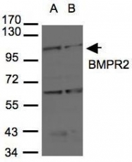 NBP1-32218 - BMPR2