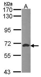 NBP1-32221 - ATIC / PURH