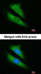 NBP1-32221 - ATIC / PURH