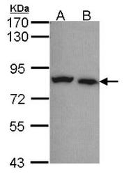NBP1-32222 - Calpain-5
