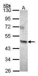 NBP1-32224 - ACAD8
