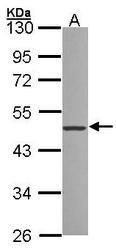 NBP1-32228 - ZNF277