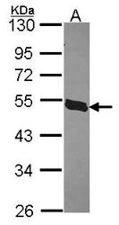 NBP1-32246 - IL22RA2
