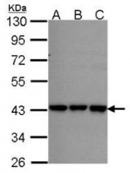 NBP1-32253 - RFC2 / RFC40