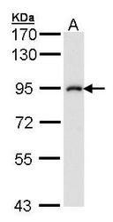 NBP1-32258 - IKBKB / IKKB