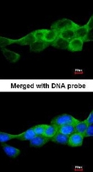 NBP1-32258 - IKBKB / IKKB