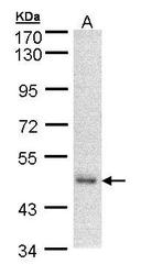 NBP1-32278 - DNAJA2