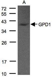 NBP1-32279 - GPD1L