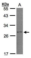 NBP1-32284 - RGS2