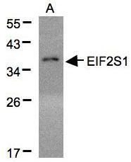 NBP1-32289 - EIF2A / EIF2S1