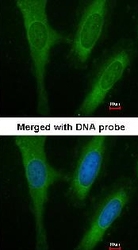 NBP1-32296 - BCAP31 / BAP31
