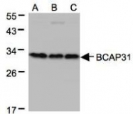 NBP1-32296 - BCAP31 / BAP31