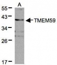 NBP1-32303 - TMEM59