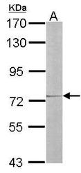 NBP1-32307 - IL17RD
