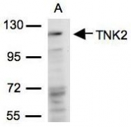 NBP1-32311 - TNK2 / ACK1