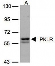 NBP1-32314 - PKLR