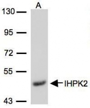 NBP1-32322 - InsP6 kinase 2 / IP6K2