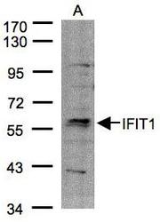 NBP1-32329 - IFI56 / IFIT1
