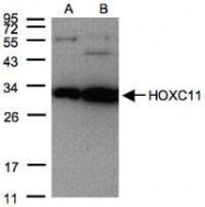 NBP1-32331 - HOXC11 / HOX3H