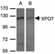 NBP1-32350 - XPO7 / Exportin-7