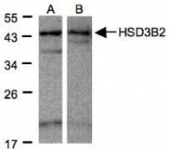 NBP1-32353 - 3-beta HSD2 / HSD3B2