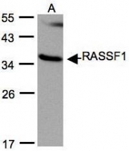 NBP1-32361 - RASSF1