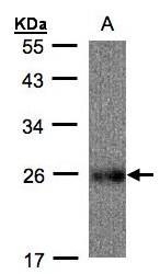 NBP1-32367 - UQCRFS1 (Complex III subunit Rieske)
