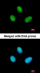 NBP1-32370 - Retinol-binding protein 2 / RBP2