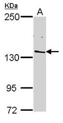 NBP1-32370 - Retinol-binding protein 2 / RBP2
