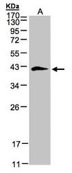 NBP1-32371 - Biglycan