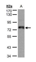 NBP1-32386 - ZNF7