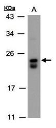 NBP1-32399 - DUSP19