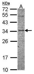 NBP1-32422 - ZNF397