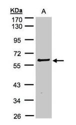 NBP1-32424 - RIPK2