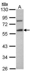 NBP1-32436 - Fibrinogen gamma chain