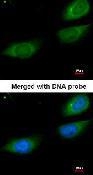 NBP1-32436 - Fibrinogen gamma chain