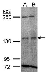 NBP1-32450 - TYK2