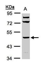 NBP1-32465 - HYAL1 / Hyaluronidase-1