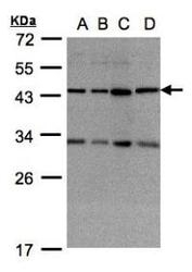 NBP1-32472 - DNAJC17