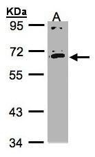 NBP1-32481 - IL17RC