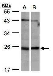 NBP1-32494 - ITPA
