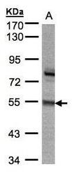 NBP1-32507 - ZNF165