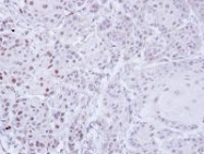 NBP1-32507 - ZNF165