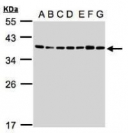 NBP1-32515 - U2AF1 / U2AF35