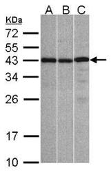 NBP1-32522 - ZC3H8