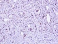 NBP1-32522 - ZC3H8