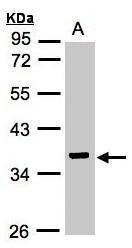 NBP1-32526 - Isocitric dehydrogenase gamma / IDH3G