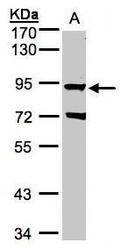 NBP1-32534 - Beta-ARK-1 / ADRBK1