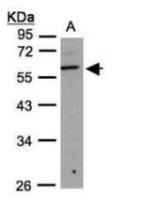 NBP1-32539 - B3GNT3 / B3GALT8